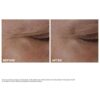 Duo Double Serum Eye + Total Eye Lift | Routine anti-âge pour les yeux la plus vendue | Total Eye Lift, pour un lifting visible du contour des yeux en 30 secondes