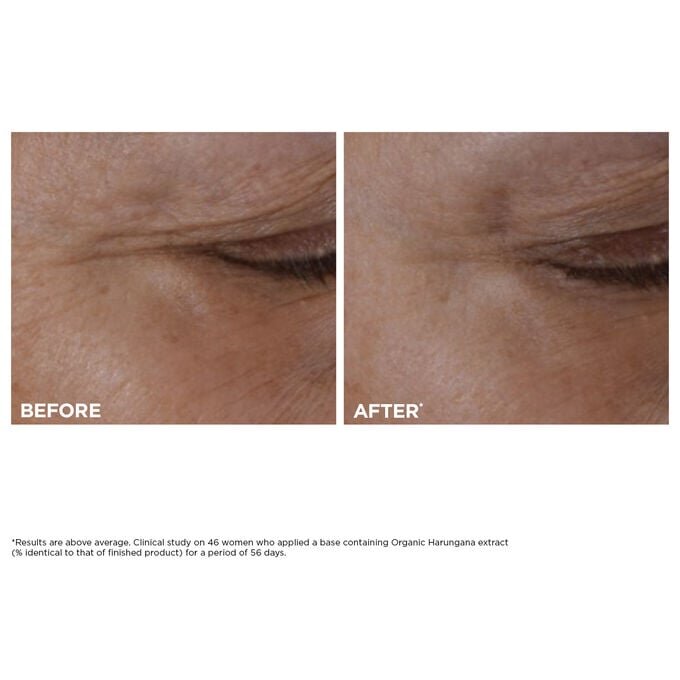 Duo Double Serum Eye + Total Eye Lift | Routine anti-âge pour les yeux la plus vendue | Total Eye Lift, pour un lifting visible du contour des yeux en 30 secondes
