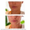 Masque visage décongestionnant V-Facial Intensive Wrap